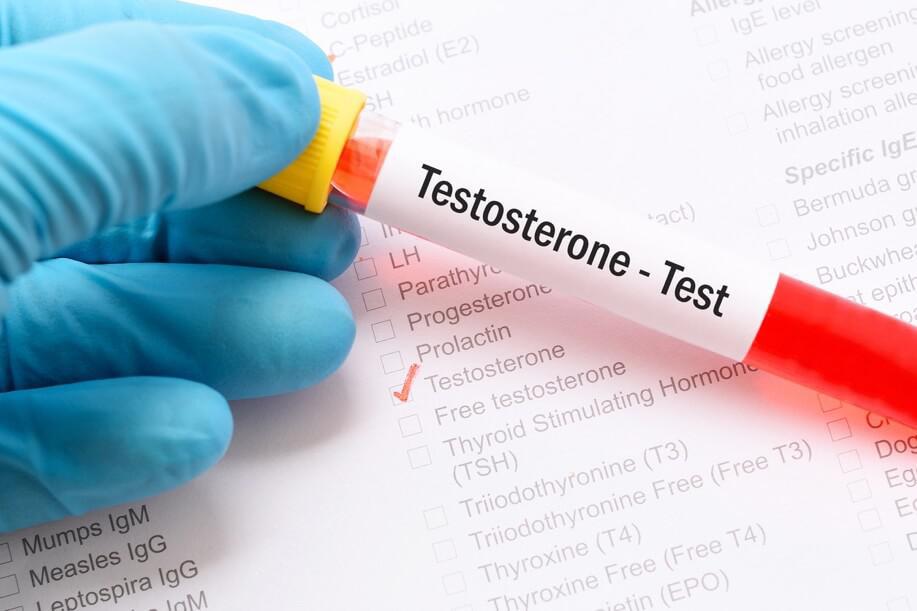 7 Proven Ways to Naturally Boost Your Testosterone Levels