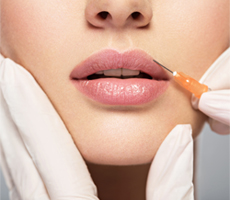 Dermal Fillers