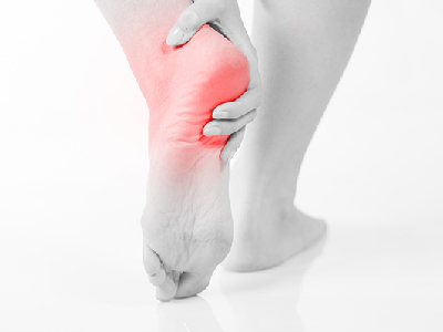 Plantar Fasciitis