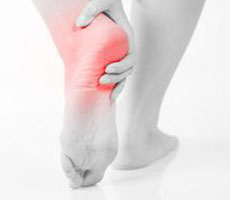 Plantar Fasciitis